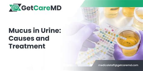 ano ang mucus threads sa tagalog meaning|Mucus in urine: Causes, tests, and treatment .